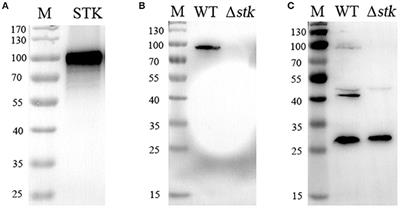 Streptococcus suis DivIVA Protein Is a Substrate of <mark class="highlighted">Ser/Thr Kinase</mark> STK and Involved in Cell Division Regulation